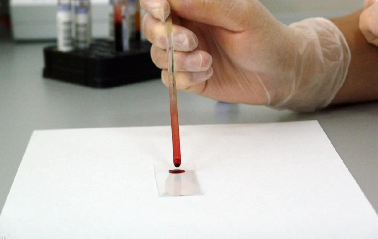 Ученые из Университета Дьюка разработали метод предсказания продолжительности жизни человека